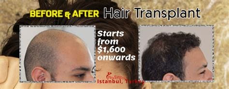 Do I need to cover my hair in Istanbul?